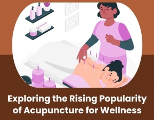 Exploring the Rising Popularity of Acupuncture for Wellness