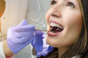 Clear Aligners vs. Traditional Braces: Which Orthodontic Option is Best?