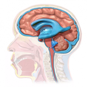 Hydrocephalus Shunts Market Will Grow Fastest Due to Telemetric Monitoring