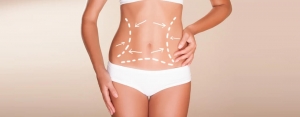 Liposuction: Sculpt Your Ideal Shape and Boost Confidence