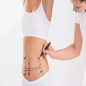 How to Choose the Best Clinic for Liposuction in Dubai