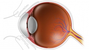 Primary Ciliary Dyskinesia Market is Anticipated to Witness High Growth Owing to Gene Therapy Advancements