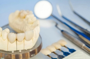 London Teeth Crown Services Can Restore Your Healthy Smile