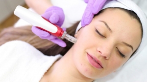 Can Micro-needling Be Combined with Other Treatments for Acne Scars in Dubai