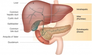 Cholangiocarcinoma Market Advances in Targeted Therapy: 2024–2033