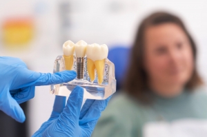 Dental Implants Norwich