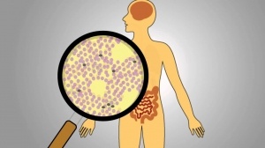 Acute Radiation Syndrome Market to Grow on Rising Radiation Exposure