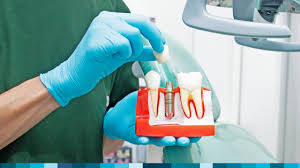 Why Real-World Patient Experience is Key to Mastering Dental Implant Training