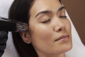 Restore Your Skin’s Firmness and Glow with Morpheus8