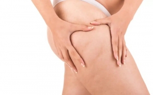 Autologous Fat Grafting|Napa Solano Plastic Surgery