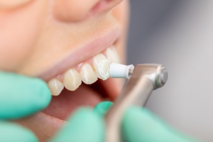 Nano Whitening: Gentle on Enamel, Tough on Stains