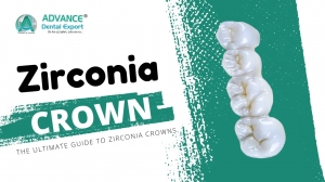 The Ultimate Guide to Zirconia Crowns