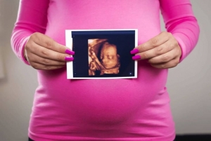 Luxury Maternity Photography & 3D Ultrasound in Sacramento