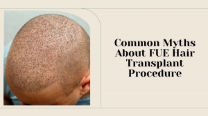 Common Myths About FUE Hair Transplant Procedure