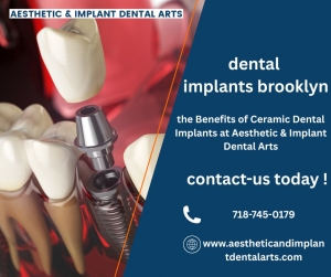 Will Insurance Pay for Dental Implants? 