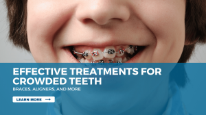 Effective Treatments for Crowded Teeth: Braces, Aligners, and More