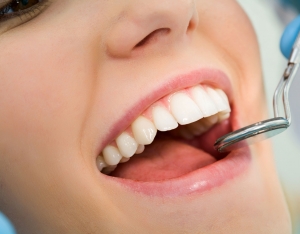 What Are the Benefits of Choosing a Houston Dental Specialist for Your Cosmetic Smile Makeover in Houston?