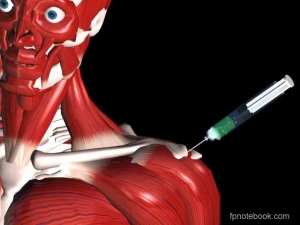 How to Administer the Best Acromioclavicular Injection?