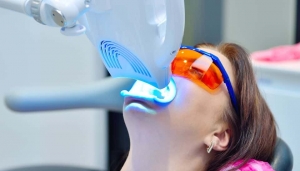 Zoom Whitening: Everything You Need to Know Before Booking