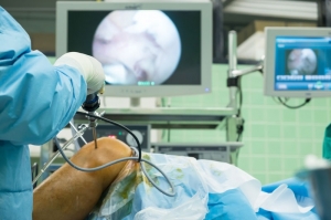 Arthroscopy Surgery Delhi: Advanced Joint Care MadeEasy