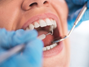 Your Ultimate Guide to Finding the Right Dental Care: From Invisalign to Sleep Solutions