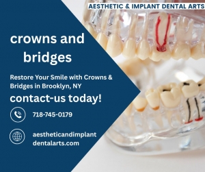 How much does a crown and bridge cost?