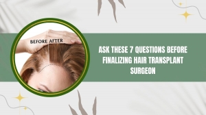Ask These 7 Questions Before Finalizing Hair Transplant Surgeon