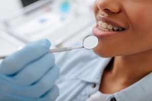 How Long Does Orthodontic Treatment Really Take?