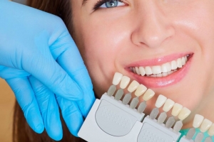Smile Makeover Secrets: Why Celebrities Love Non-Prep Veneers