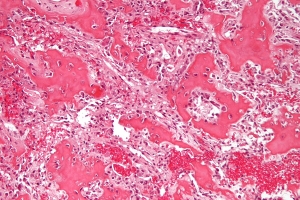 Human Osteoblasts Market to Witness Robust Growth Owing to Increasing Demand for Regenerative Medicine