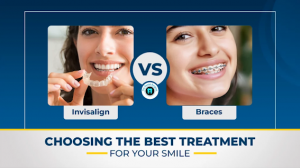 Invisalign vs Braces: Choosing the Best Treatment for Your Smile Goals