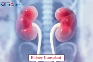 Kidney Transplant Surgery in India: Quality Care at an Affordable Co