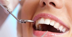 The Truth About Smile Makeovers: What to Expect