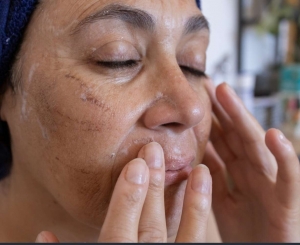 Does Chemical Peels Aid Skin Shedding?