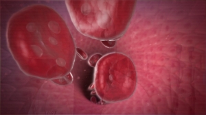 Warm Autoimmune Hemolytic Anemia Market to Expand on Novel Therapeutics