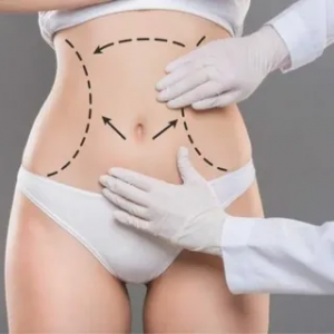 Tummy Tuck Financing and Payment Plans in Islamabad
