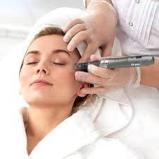 Transform Your Skin with Microneedling in Peshawar