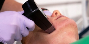 Discover Instant Skin Rejuvenation with Morpheus8 Treatment in Dubai