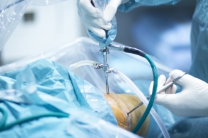 Top 5 Key Factors That Affect Knee Replacement Surgery Costs in Pakistan (2025 Guide)