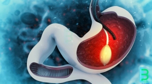 Intragastric Balloon Market is Anticipated to Witness High Growth Owing to Rising Obesity Rates