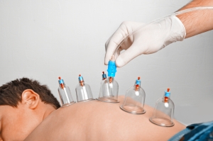 How Hijama Connects Mind and Body Wellness?