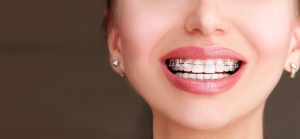 Dental Tourism: Why People Travel to Dubai for Orthodontics