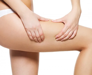 Are There Non-Invasive Cellulite Treatments in Dubai That Really Work