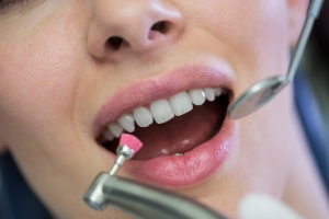 What to Expect During Your First Cosmetic Dentistry Consultation