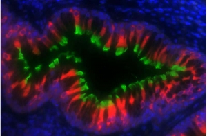 Primary Ciliary Dyskinesia Market Poised for Growth Due to Diagnostic Innovations