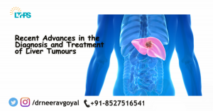 Recent Advances in the Diagnosis and Treatment of Liver Tumours