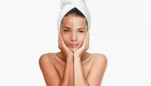 Skin Whitening vs. Skin Brightening: What’s Popular in Islamabad?