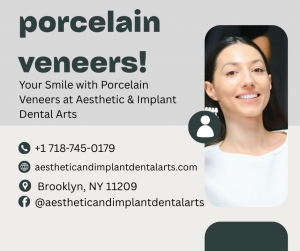 Everything You Need to Know About Porcelain Veneers  