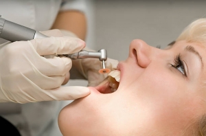 Dental Experts for Teeth Polishing in Riyadh