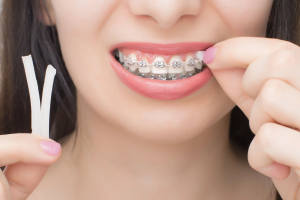 How the Best Orthodontists Make Braces Easier for Kids
